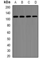 Polyclonal Rabbit anti-Human HK2 / Hexokinase 2 Antibody (IF, WB)