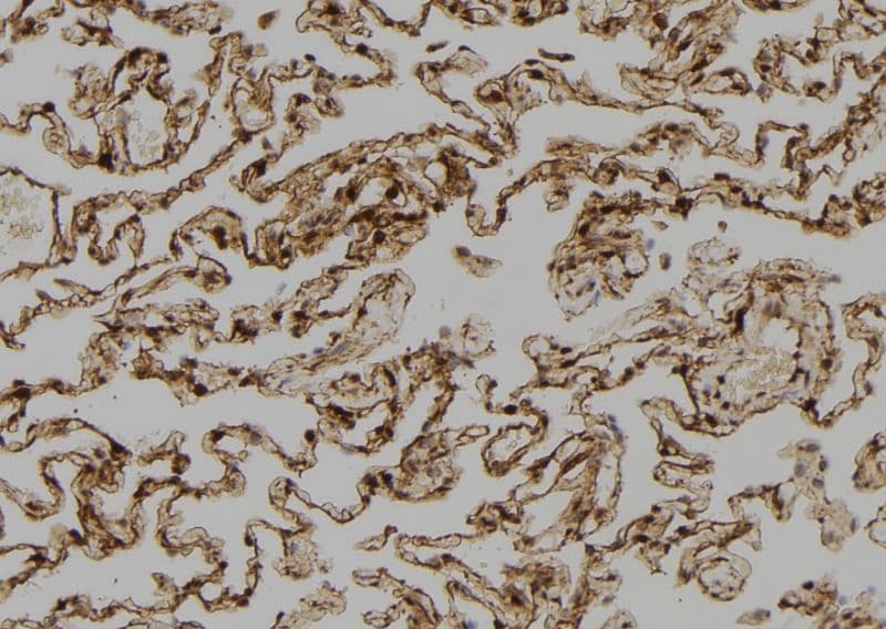 SH3BP2 Antibody