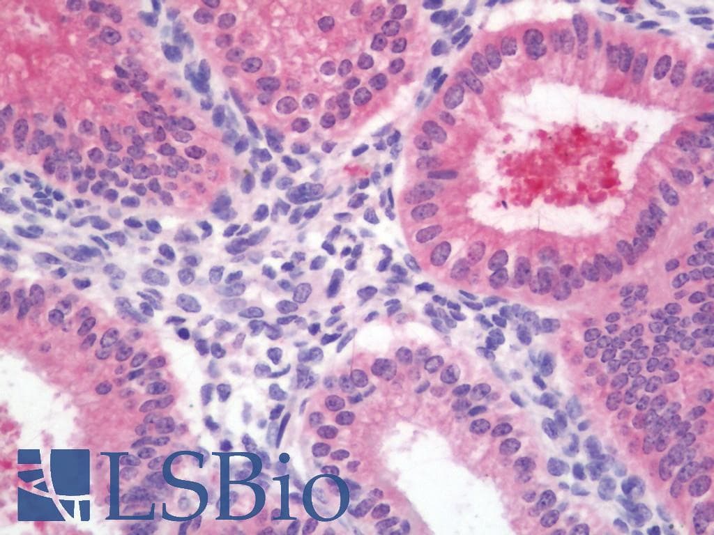 IHC-plus™ DNAJC10 Antibody (clone 3C4)