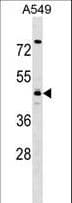 TMOD4 Antibody (aa150-176)