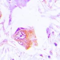 NCF1 / p47phox / p47 phox Antibody (C-Terminus)