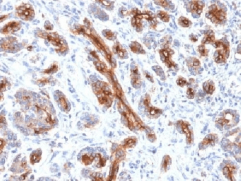 CFTR Antibody (clone CFTR/1341)
