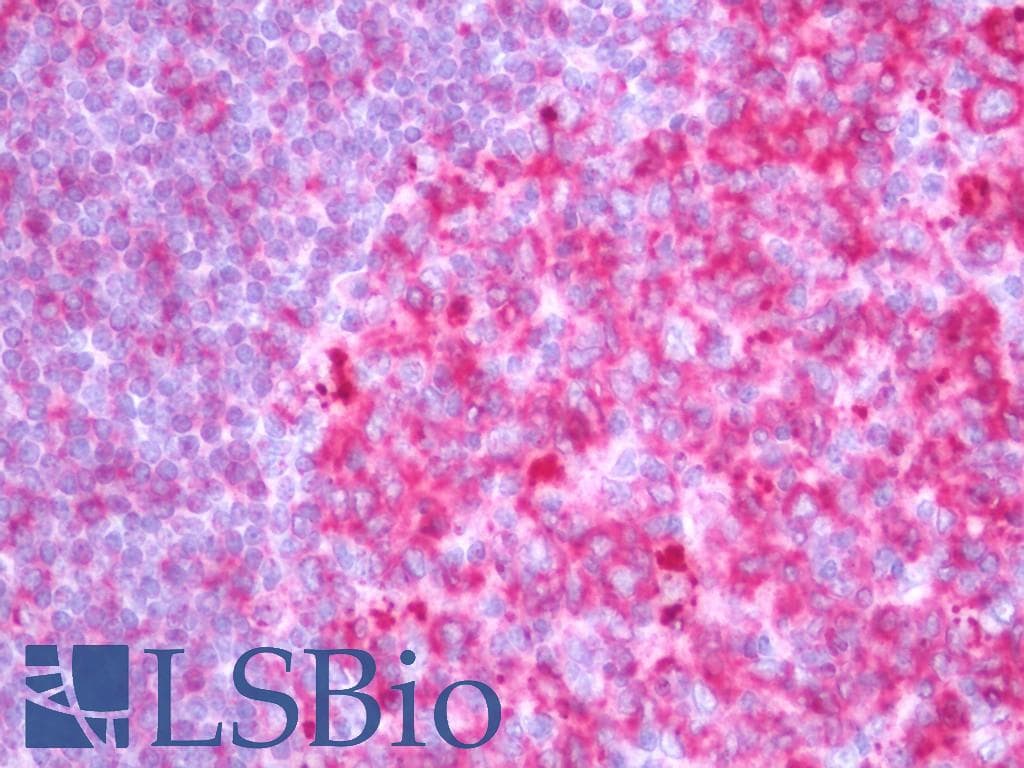 IHC-plus™ HLA Class II Histocompatibility Antigen, DRB1-3 Antibody
