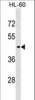 Polyclonal Rabbit anti-Human EIF2B3 Antibody (aa413-441, WB)