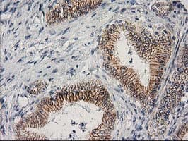 CTNNB1 / Beta Catenin Antibody (clone OTI1E10, Carrier-free)