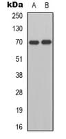 Polyclonal Rabbit anti-Human HGFAC / HGFA Antibody (C-Terminus, WB)