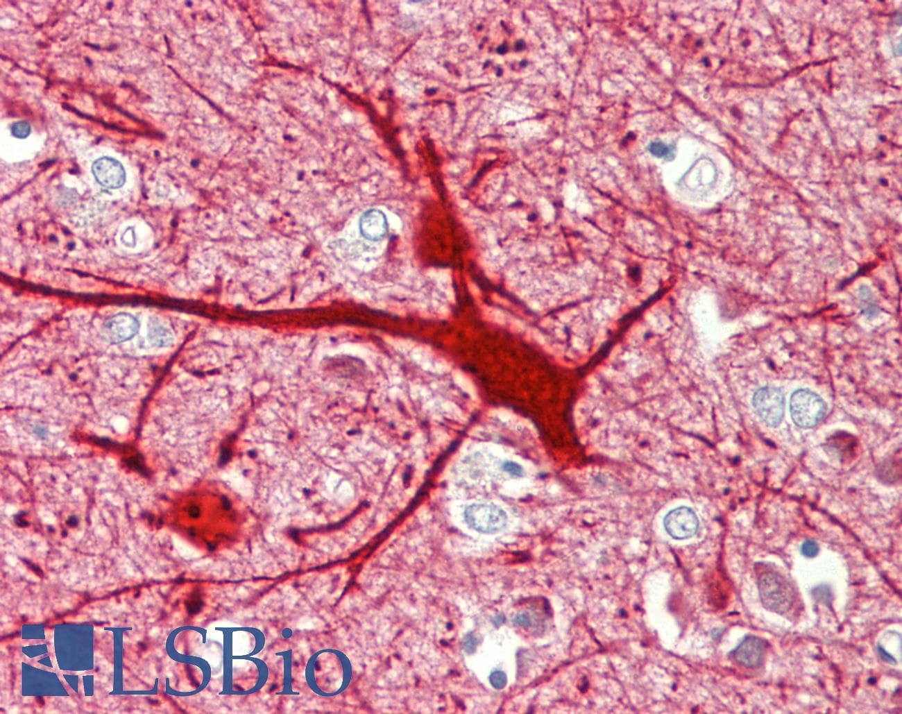 IHC-plus™ TAC3 / Tachykinin Antibody (aa54-83)