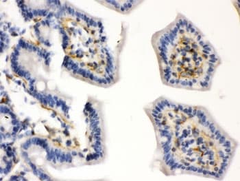 CALD1 / Caldesmon Antibody