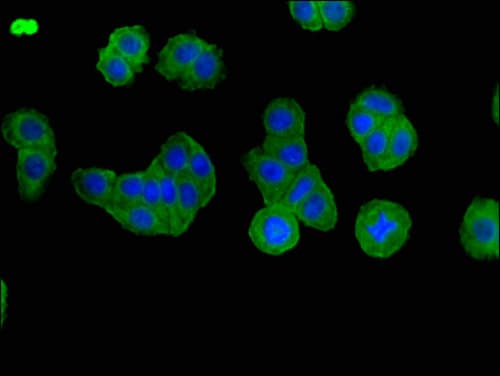 BBS1 Antibody