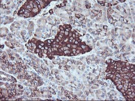 SULT1A1 / Sulfotransferase 1A1 Antibody (clone OTI5A1)