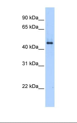 SERPINE1 / PAI-1 Antibody (aa31-80)
