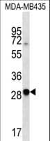 Polyclonal Rabbit anti-Human CXCR6 Antibody (aa3-31, WB)
