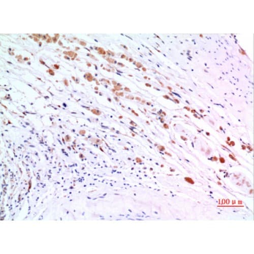 ZNF307 Antibody (Internal)