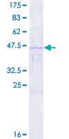 Human RARRES3 Protein (Recombinant GST)