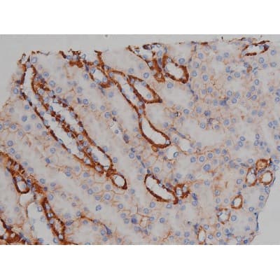 MAPT / Tau Antibody (phospho-Ser356)