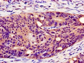 PLIN1 / Perilipin Antibody