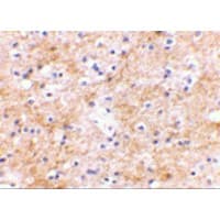 DLGAP3 / SAPAP3 Antibody