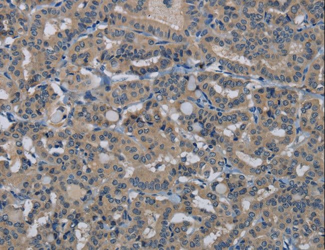 HSPG2 / Perlecan Antibody