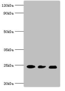 RAB5A / RAB5 Antibody (aa1-215)
