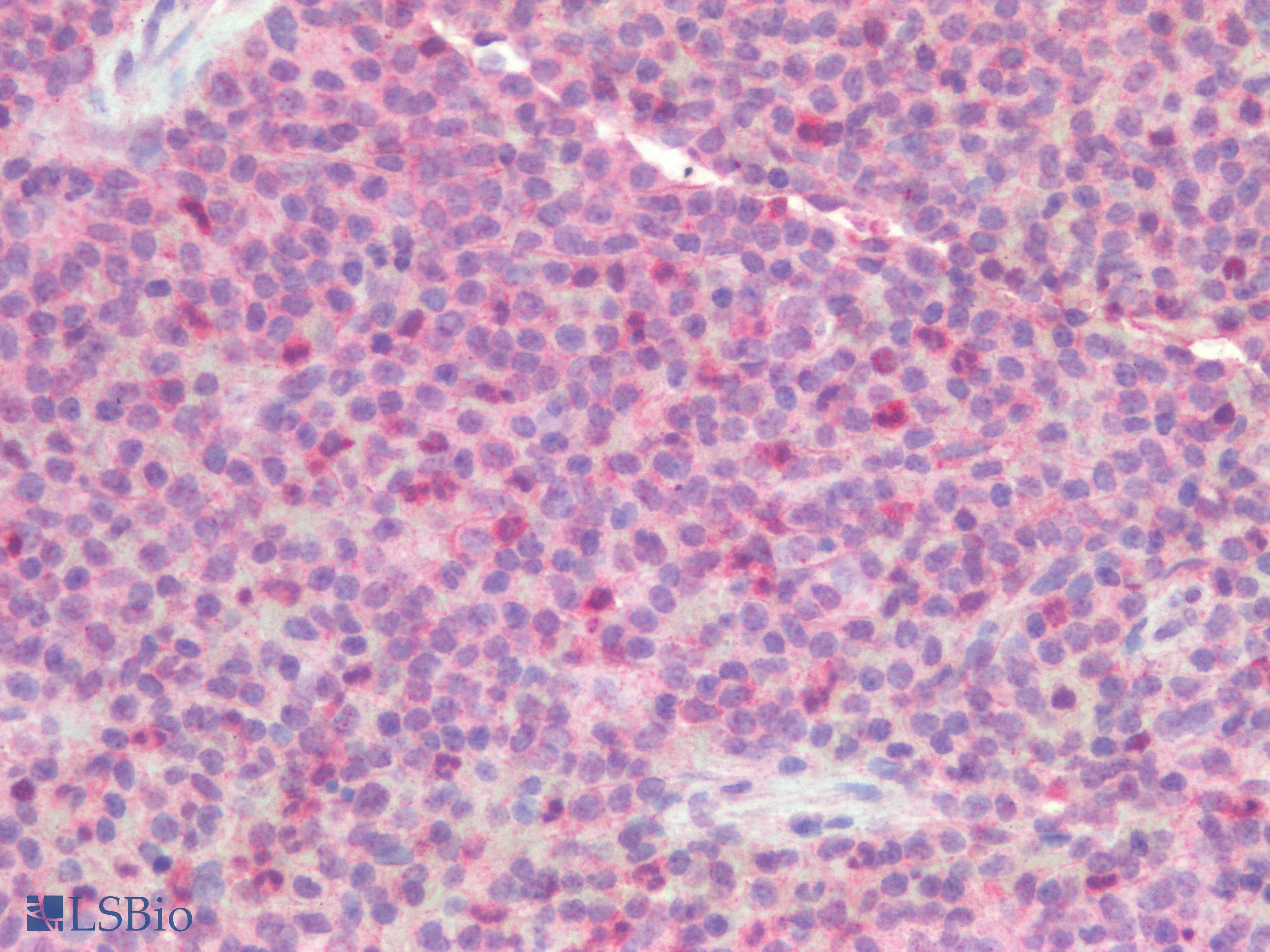 IHC-plus™ Polyclonal Rabbit anti-Human TSLP Antibody (IHC)