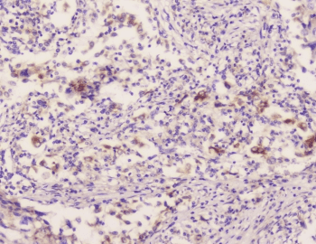 EML4 Antibody