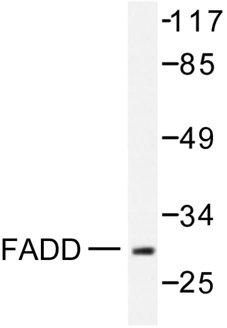 Polyclonal Rabbit anti-Human FADD Antibody (Asn188, IHC, WB)