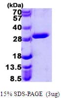 Human UROS Protein (Recombinant His)