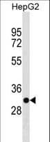 Polyclonal Rabbit anti-Human TARM1 Antibody (aa243-270, WB)