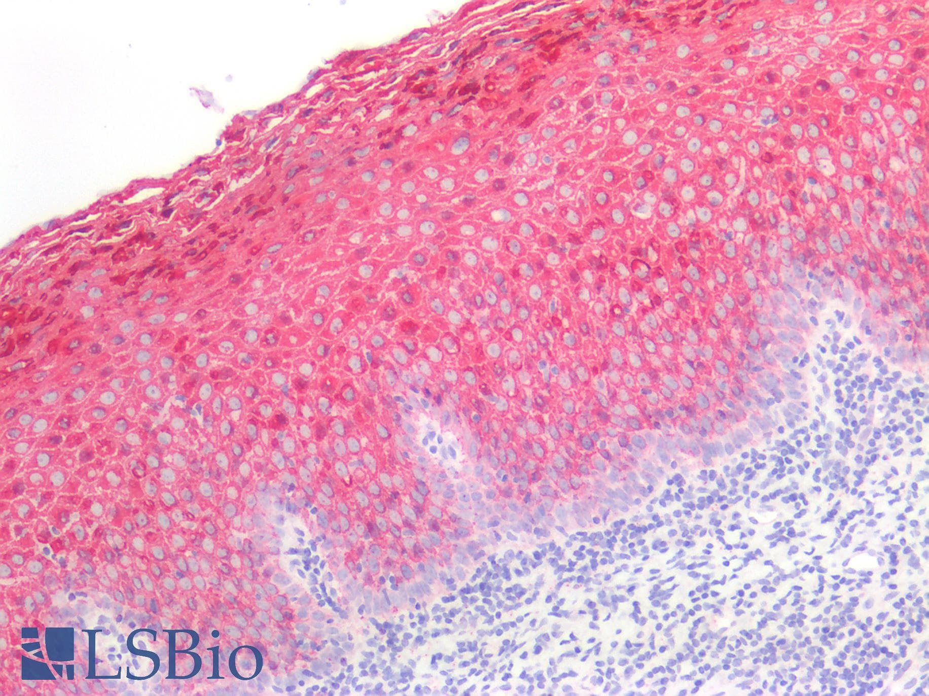 PathPlus™ KRT13 / CK13 / Cytokeratin 13 Antibody