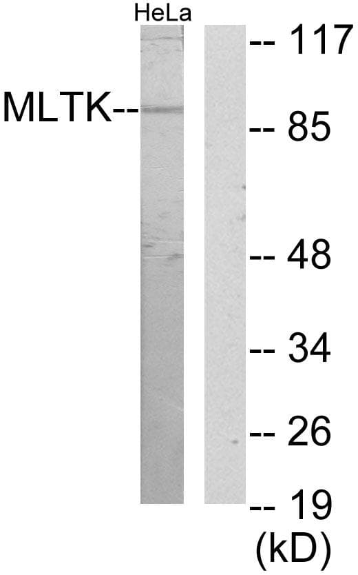 ZAK / MLTK Antibody
