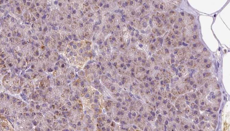 PIK3IP1 / HGFL Antibody
