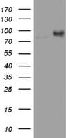 NBN / Nibrin Antibody (aa183-460, clone OTI5E11, Carrier-free)