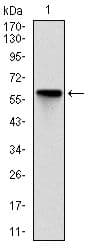 Monoclonal Mouse anti-Human Rho Kinase / ROCK1 Antibody (clone 1H4, WB)