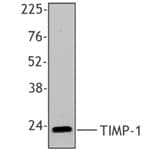 Monoclonal Mouse anti-Human TIMP1 Antibody (clone F31P2A5, WB)