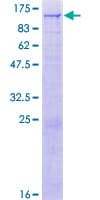 Human TRMT1L Protein (Recombinant GST)