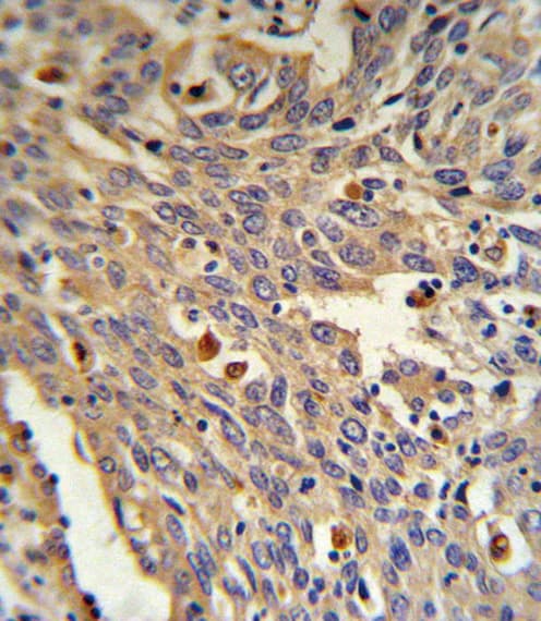 Polyclonal Rabbit anti-Human GLA / Alpha Galactosidase Antibody (aa83-112, IHC, IF, WB)