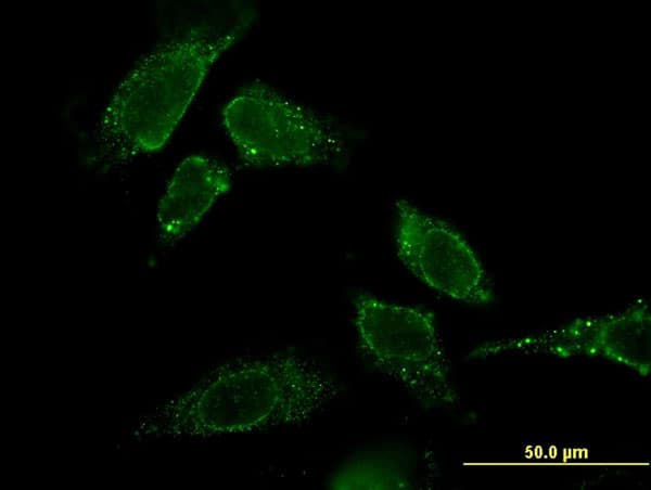 CBR3 Antibody (clone 1G8)