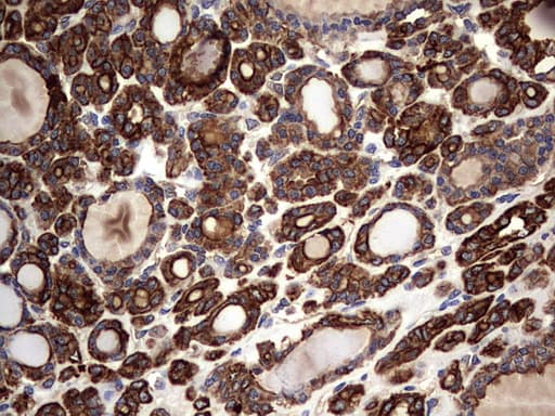 KRT7 / CK7 / Cytokeratin 7 Antibody (clone OTI2A2)
