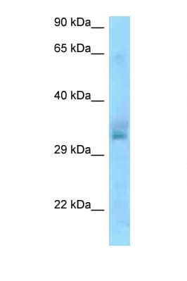 Polyclonal Rabbit anti-Human UCP1 / UCP-1 Antibody (aa77-126, WB)