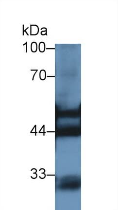 KRT7 / CK7 / Cytokeratin 7 Antibody (aa255-393, Cy3)