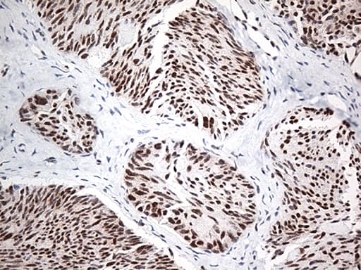 EWSR1 / EWS Antibody (aa256-447, clone OTI3F6, Carrier-free)