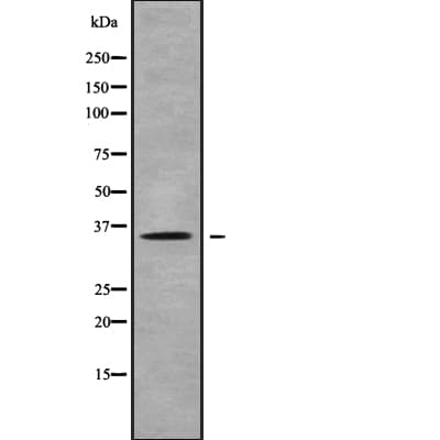 Polyclonal Rabbit anti-Human OR10H5 Antibody (IHC, WB)