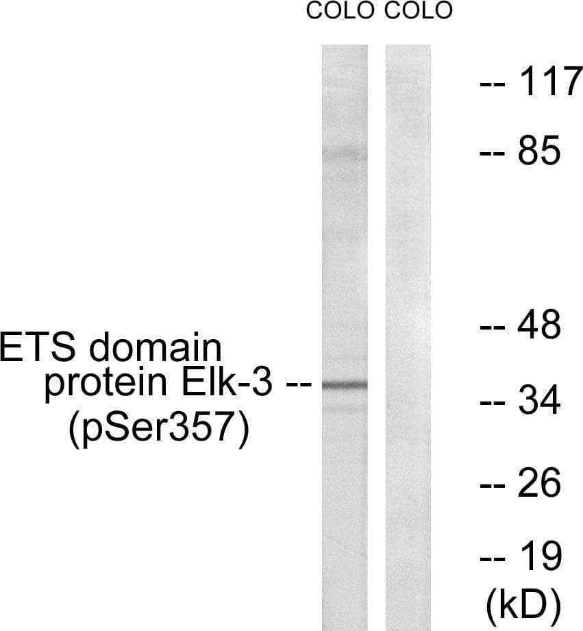 ELK3 / NET Antibody (phospho-Ser357)