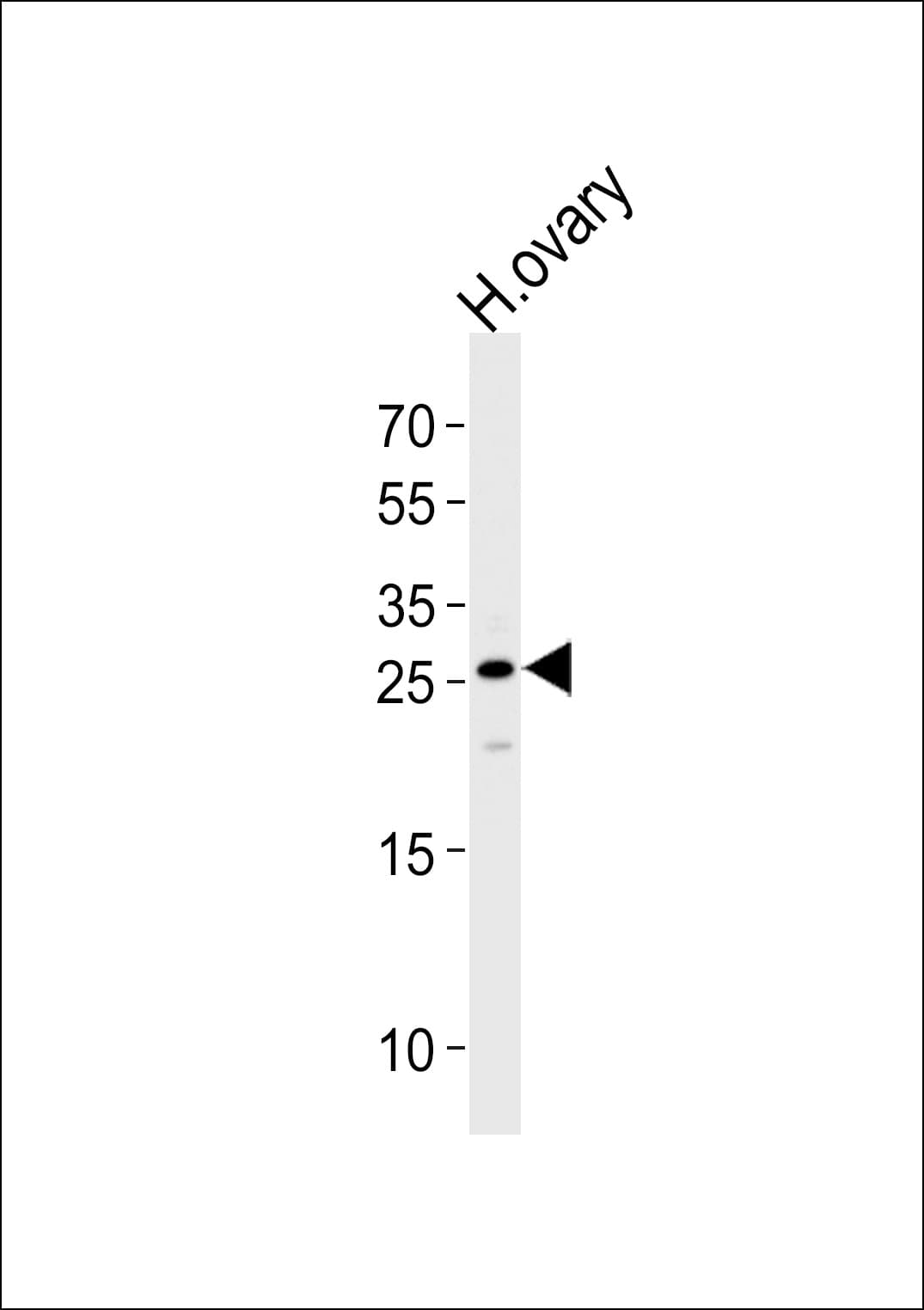 CCDC90B Antibody (aa123-152)