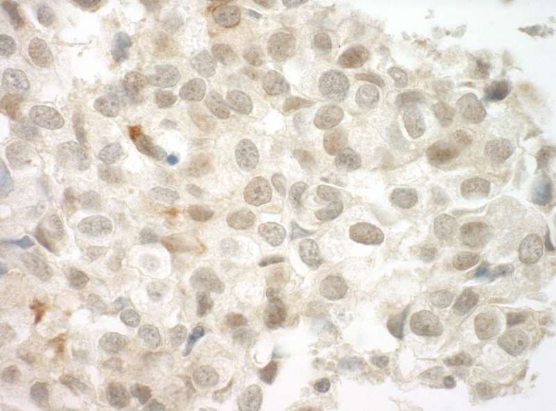 PRCC / RCCP1 Antibody (aa125-175)