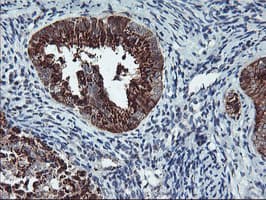 SQSTM1 Antibody (clone OTI5D5)