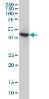 IHC-plus™ ACAA2 Antibody (clone 5C4)