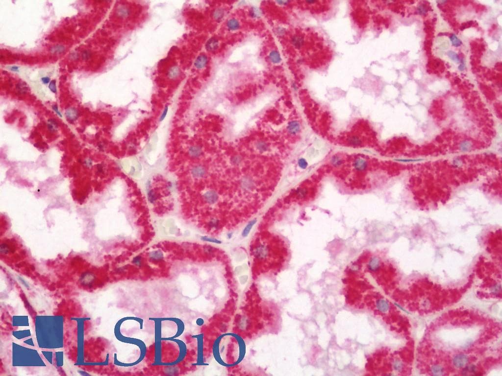 IHC-plus™ SLC1A7 / EAAT5 Antibody