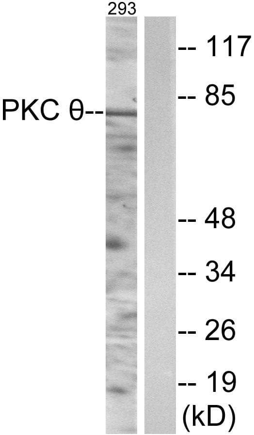 PRKCQ / PKC-Theta Antibody (p538)