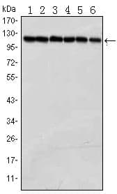 PARP1 Antibody (clone 7A10)